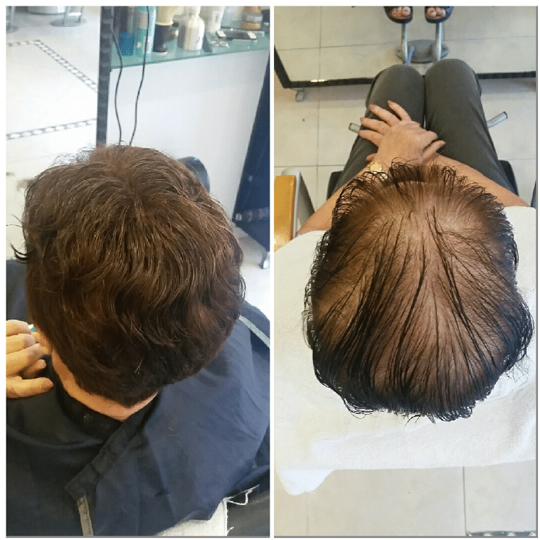 יחידות שיער (2)